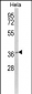MOSC2 Antibody (C-term)
